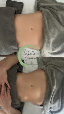 Drainage lymphatique Renata França Drainage lymphatique Renata França