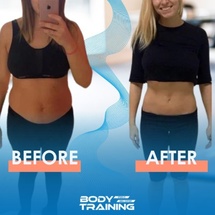 Électrostimulation musculaire (EMS) Électrostimulation musculaire (EMS)