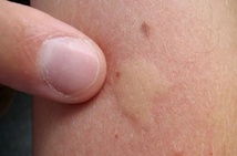 Astuce anti-moustique, Repérer moustique chambre, Éliminer moustique sommeil